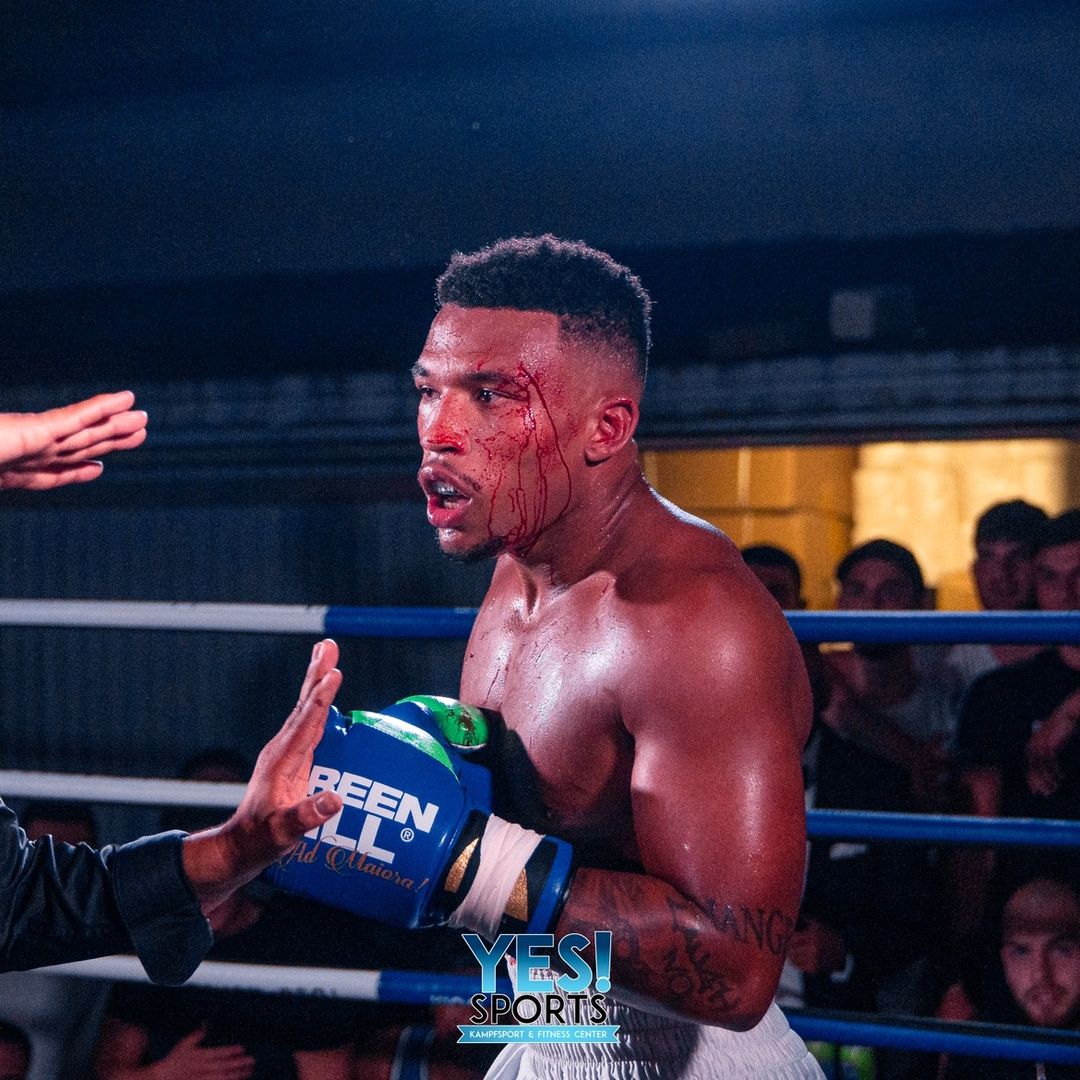 Anthonyderboxer